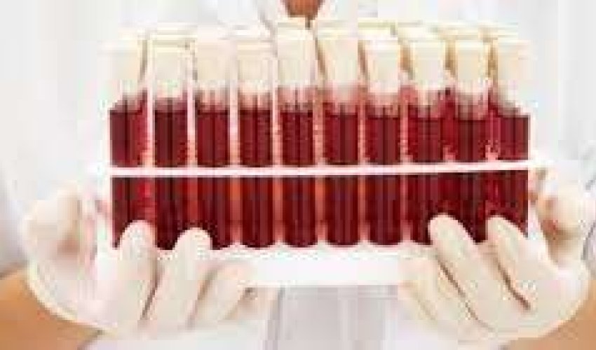 Hemofiliyalı xəstələr tam sağala bilərlər