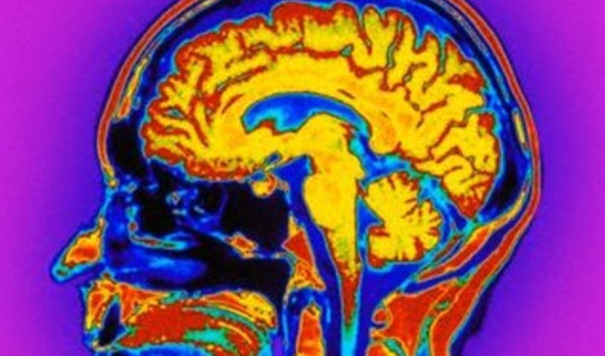 Do YOU have autistic traits?