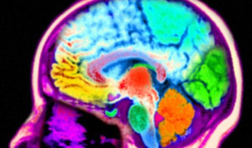 Brains of men and women are NOT different overall