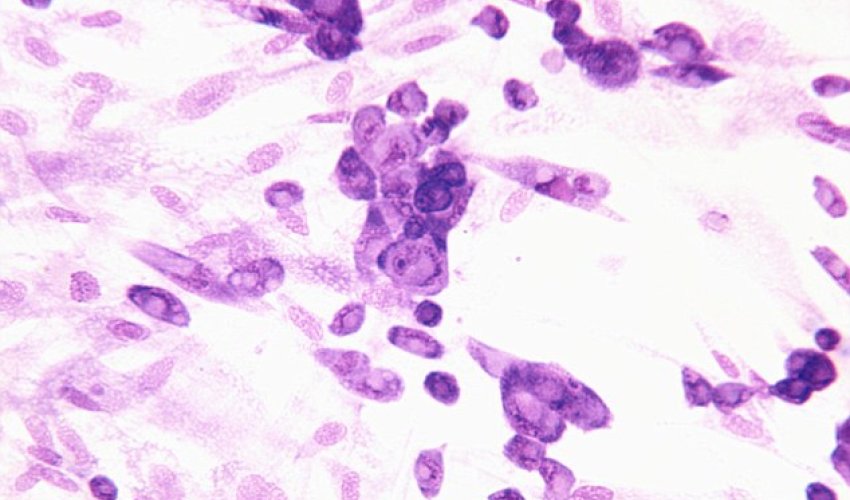 Nasa's $80,000 HERPES study