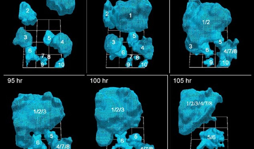 How a cancer tumor grows