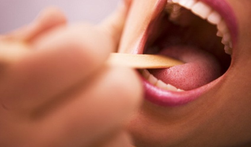 Could tonsil ops for kids cut cancer rates? Could tonsil ops for kids cut cancer rates?