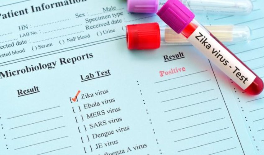 Zika found to remain in sperm for record six months