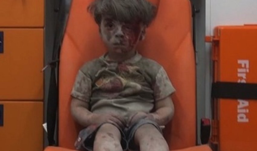 Little boy in Aleppo a vivid reminder of war`s horror