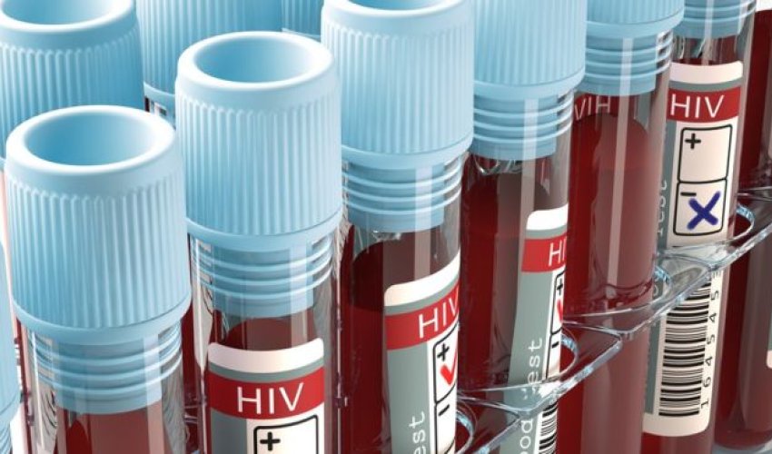 HIV effort let down by test shortages, says WHO