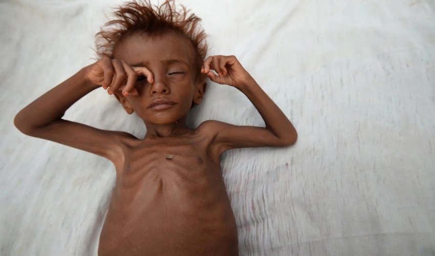 Risk of famine looms in Yemen