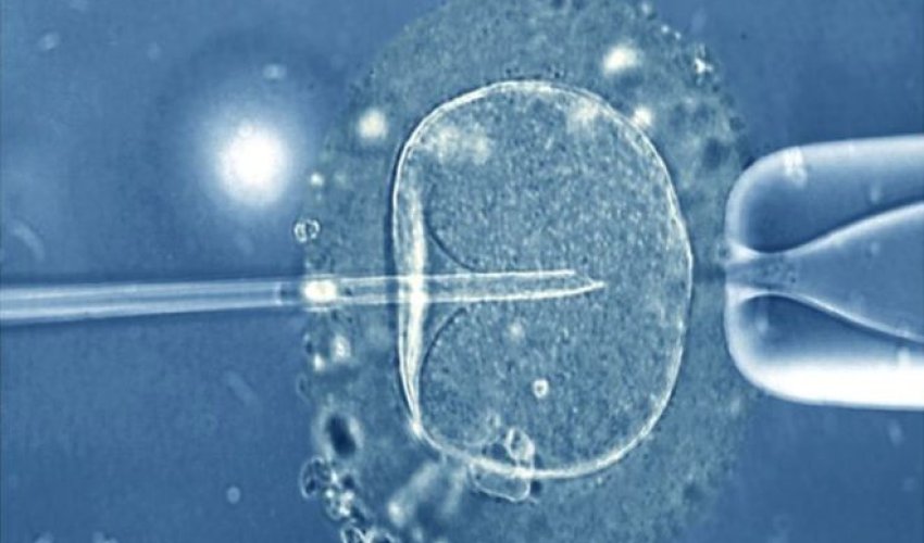 Three-person IVF baby for infertile couple