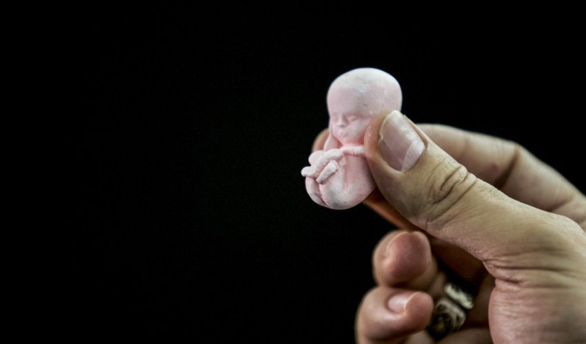 Azərbaycanda abortla bağlı yeni tələblər Azərbaycanda abortla bağlı yeni tələblər