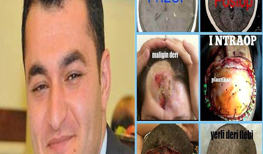 Dr.Rauf Sadıqov daha bir uğura imza atdı Dr.Rauf Sadıqov daha bir uğura imza atdı