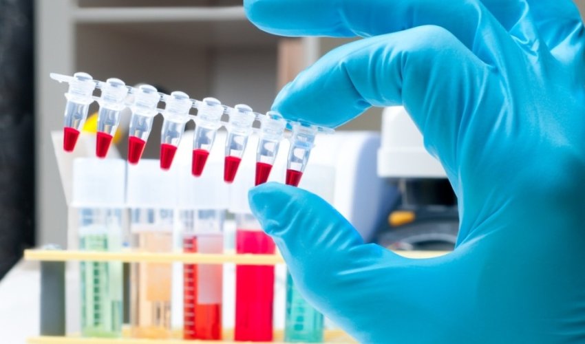 Azərbaycanda idmançının qanında morfin aşkarlanıb