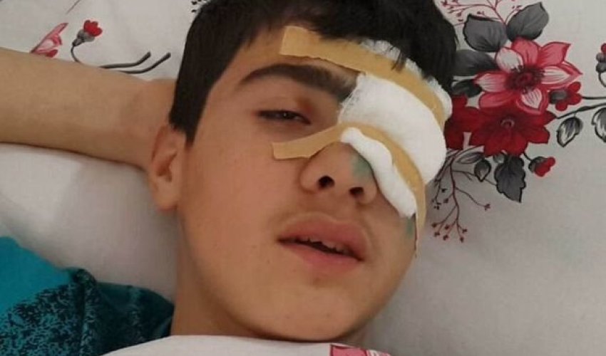 Bakıda 10-cu sinif şagirdi gözündən güllələndi – FOTO Bakıda 10-cu sinif şagirdi gözündən güllələndi – FOTO