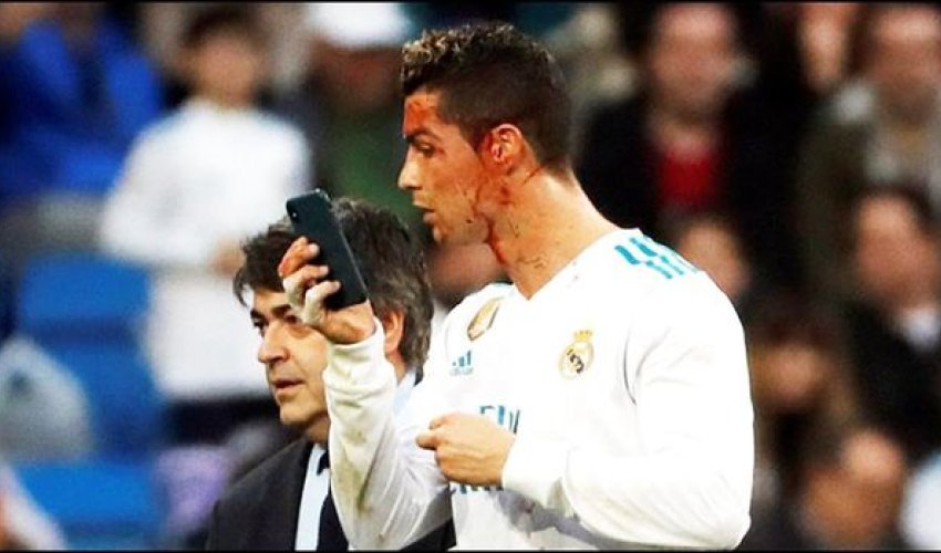 Ronaldo tanınmaz hala düşüb