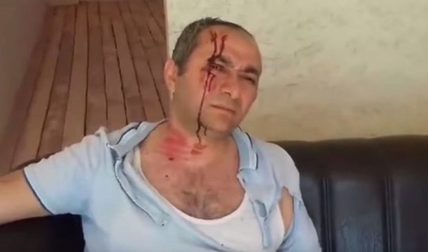 Abşeronda döyülən əlil evini yandırdı – VİDEO