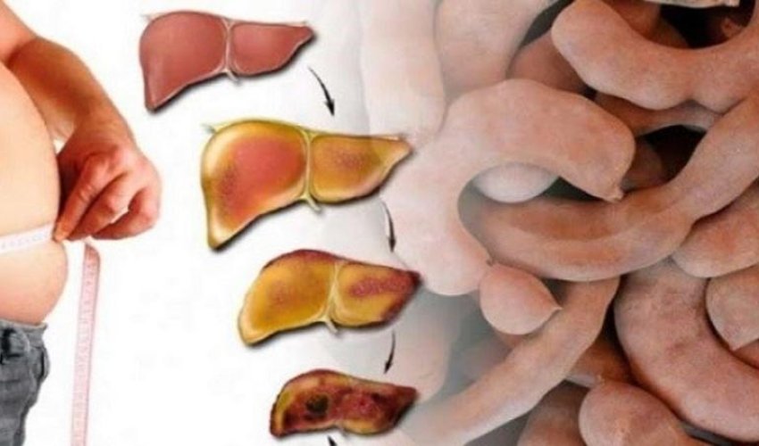 Cəmi 1 meyvə ilə 20 yaş GƏNCLƏŞİN - İnanılmaz RESEPT