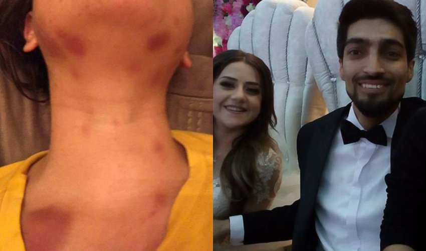 Bakıda jurnalist hamilə arvadını küçədə döyüb - FOTOLAR