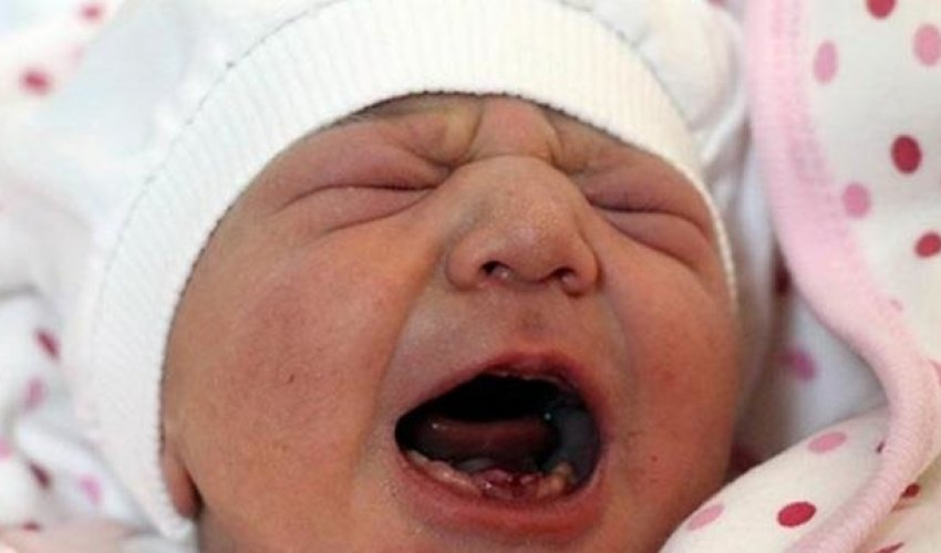 Yeni doğulan körpə hər kəsi təəcüblənirdi Yeni doğulan körpə hər kəsi təəcüblənirdi
