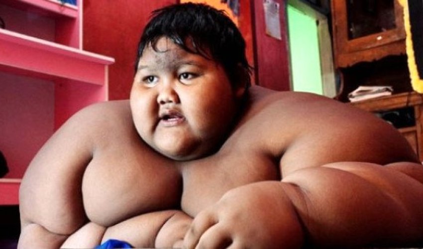 Dünyanın ən kök uşağı arqlayıb belə oldu - ŞOK FOTOLAR