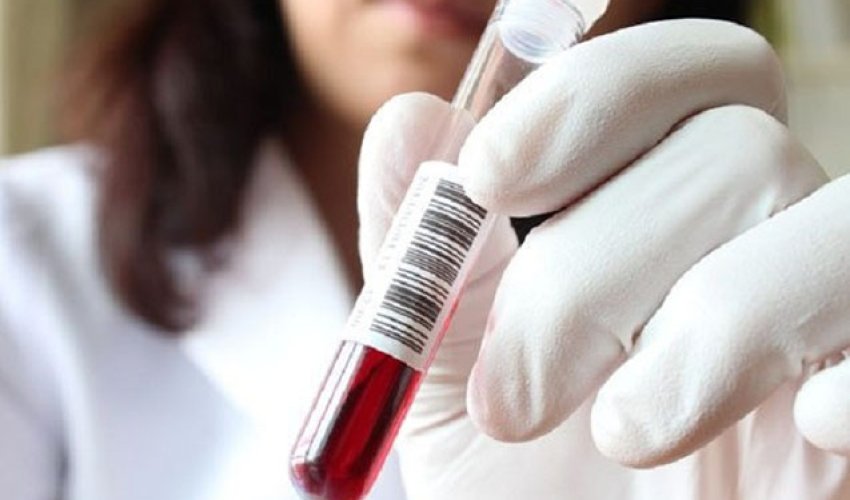 Daha bir məşhur idmançımız yarışlardan kənarlaşdırıldı