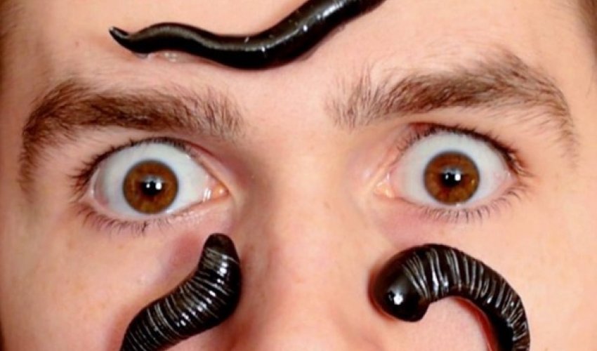 Azərbaycanda yeni zəlilər peydə oldu