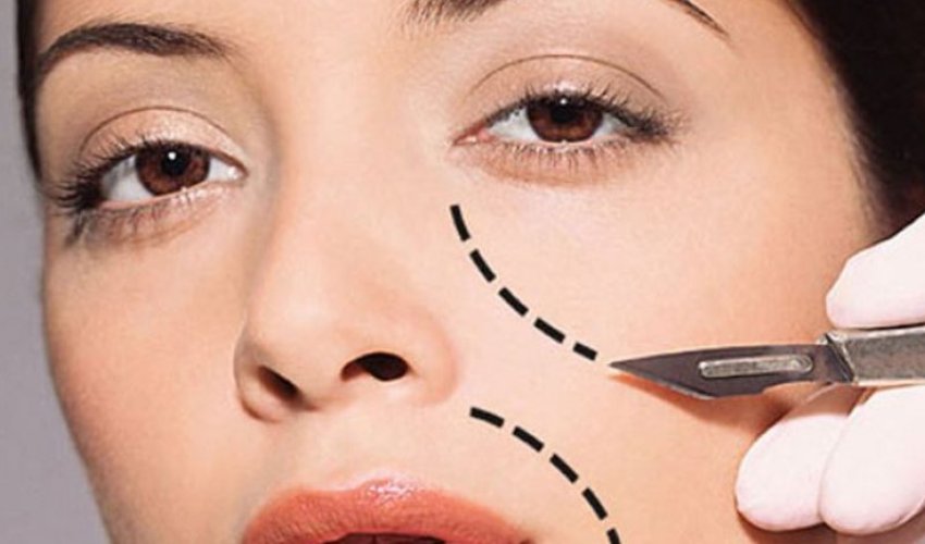 Почему в Азербайджане растет популярность пластических операций? – ВИДЕО