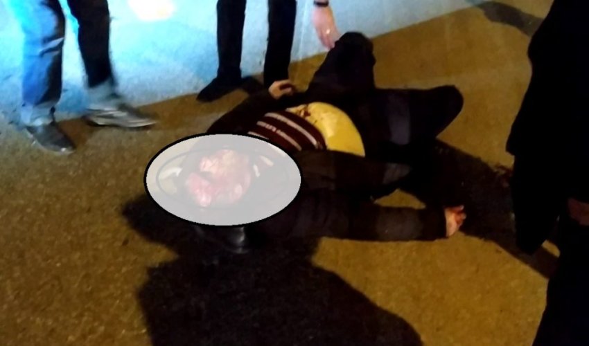 Bakıda BMW piyadanı vurub bu hala saldı – Ürəyi zəif olanlar baxmasın – VİDEO Bakıda BMW piyadanı vurub bu hala saldı – Ürəyi zəif olanlar baxmasın – VİDEO