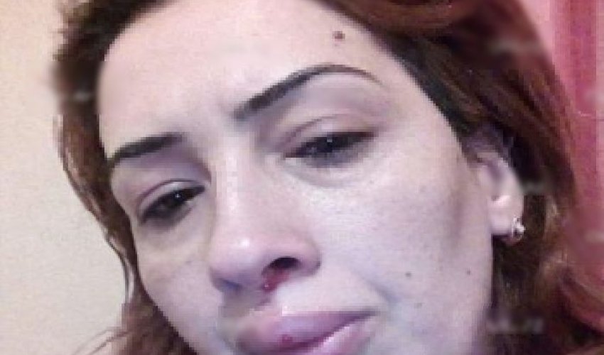 Azərbaycanlı arvadını döyərək öldürdü - FOTO