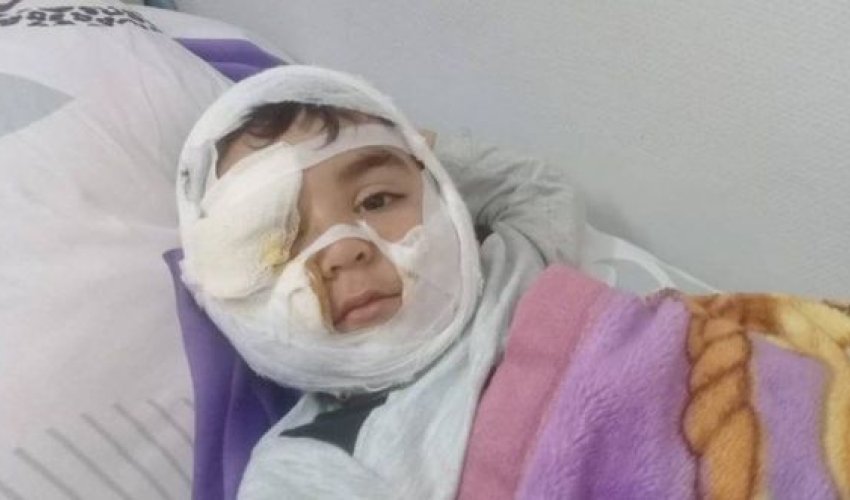 İt dişləyən uşağın atası fəryad etdi: “Həkimlər 40 gün vaxt qoyublar”
