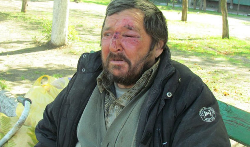 Üç ali təhsili olsa da, səfil həyatı yaşayan həmyerlimiz vətənə qaytarıldı - VİDEO+FOTOLAR