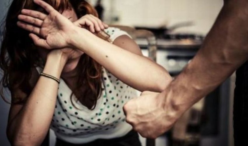 Bakıda qadın yoldaşı tərəfindən dəhşətli işgəncələrə məruz qaldı - FOTOLAR