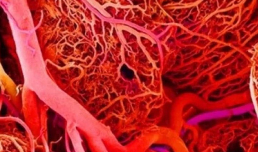 Bu əlamətlər varsa, deməli, damarlarınız 90 faiz pis işləyir – SİYAHI Bu əlamətlər varsa, deməli, damarlarınız 90 faiz pis işləyir – SİYAHI