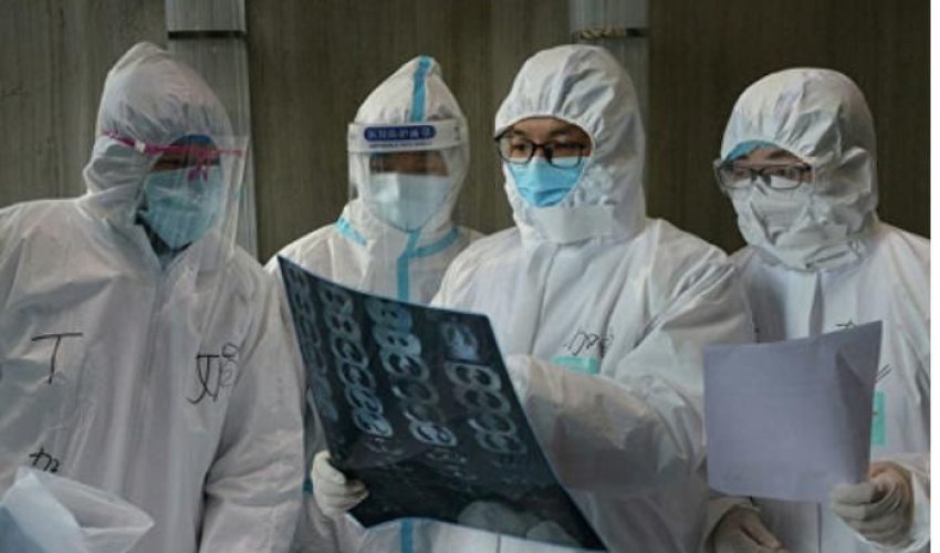DƏHŞƏT: 50-100 milyon insanı öldürən virus... — Dünyanı nə gözləyir? - VDEO DƏHŞƏT: 50-100 milyon insanı öldürən virus... — Dünyanı nə gözləyir? - VDEO