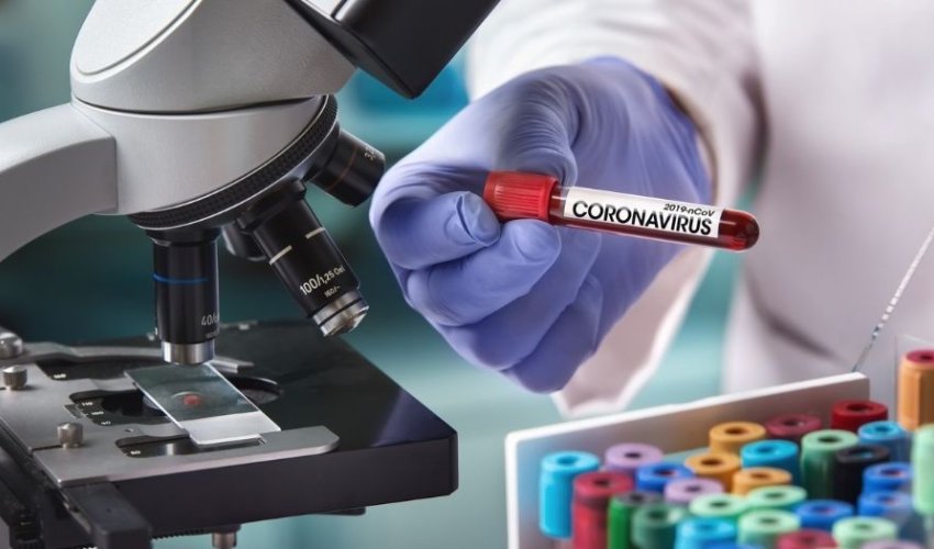 Ermənistanın iki deputatı koronavirusa yoluxdu Ermənistanın iki deputatı koronavirusa yoluxdu