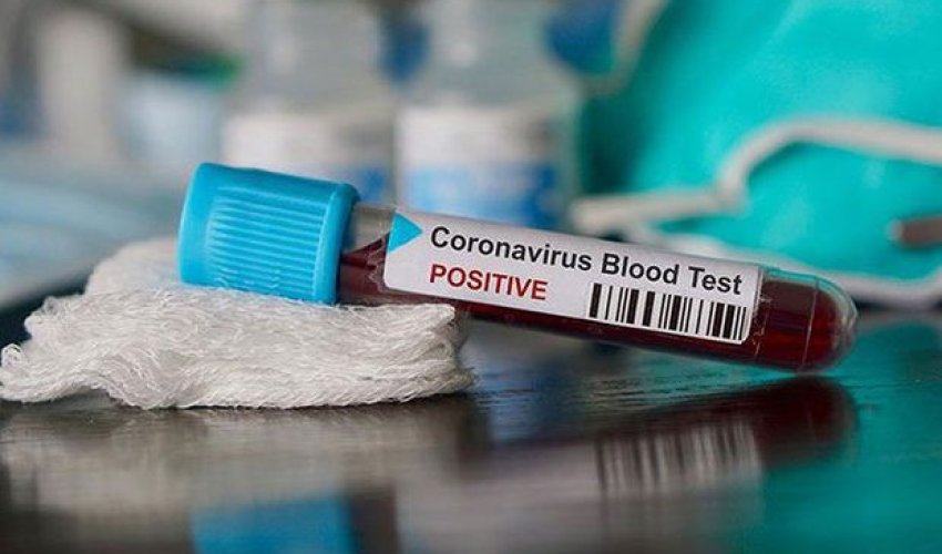 Azərbaycanda koronavirusa yoluxanlarıns ayı 822 nəfərə çatdı Azərbaycanda koronavirusa yoluxanlarıns ayı 822 nəfərə çatdı