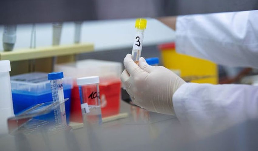 Azərbaycanda daha 39 nəfər koronavirusa yoluxdu - RƏSMİ Azərbaycanda daha 39 nəfər koronavirusa yoluxdu - RƏSMİ