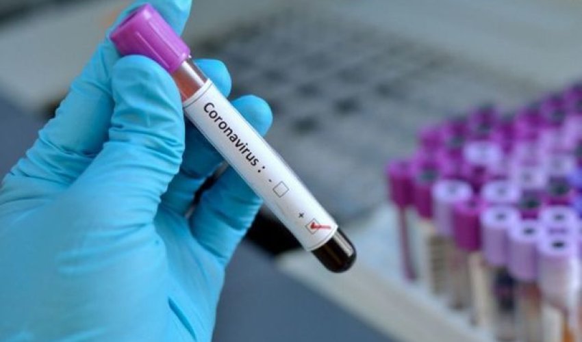 Azərbaycanda daha 40 nəfərdə koronavirus aşkarlandı - RƏSMİ Azərbaycanda daha 40 nəfərdə koronavirus aşkarlandı - RƏSMİ