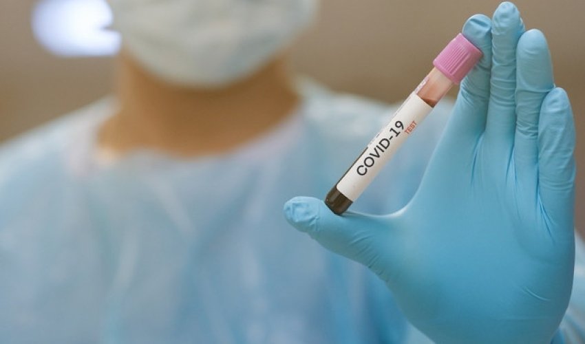 Azərbaycanda daha 77 nəfər koronavirusa yoluxdu, 15 nəfər sağaldı Azərbaycanda daha 77 nəfər koronavirusa yoluxdu, 15 nəfər sağaldı