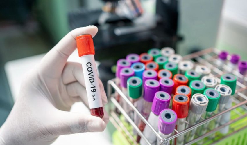 Azərbaycanda ən son koronavirus statistikası açıqlandı Azərbaycanda ən son koronavirus statistikası açıqlandı