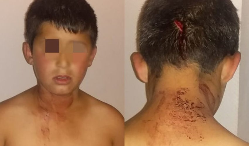 Bakıda başından bıçaqlanan uşağın dilənçiliyə cəlb edilməsi faktı təsdiqini tapmayıb - RƏSMİ