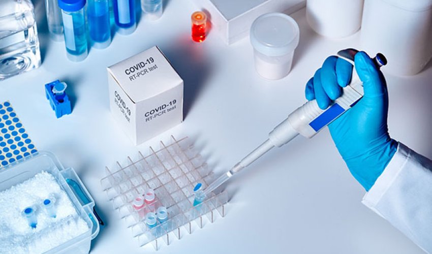 Число инфицированных COVID-19 в Азербайджане превысило 5,2 тыс Число инфицированных COVID-19 в Азербайджане превысило 5,2 тыс