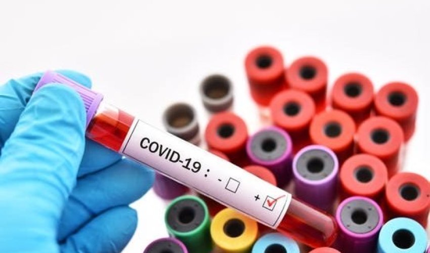 SON DƏQİQƏ: Jurnalistin ailəsində koronavirus aşkarlandı SON DƏQİQƏ: Jurnalistin ailəsində koronavirus aşkarlandı