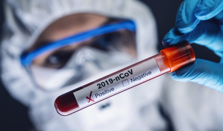 Azərbaycanda daha 325 nəfər koronavirusa yoluxub, 5 nəfər ölüb