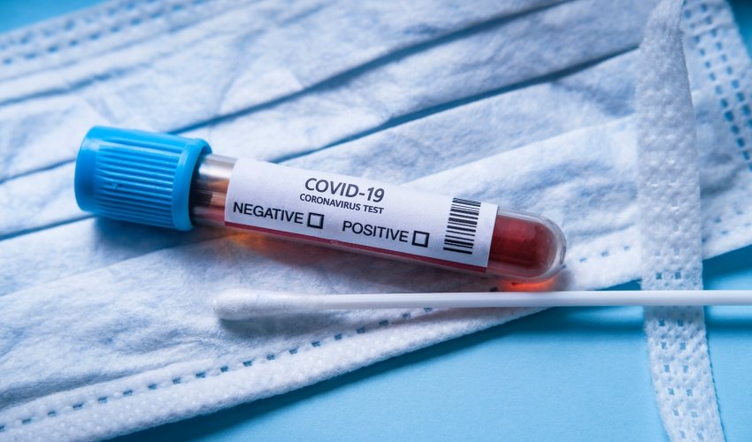 Daha 262 yeni nəfər koronavirusa yoluxub, 2 nəfər ölüb