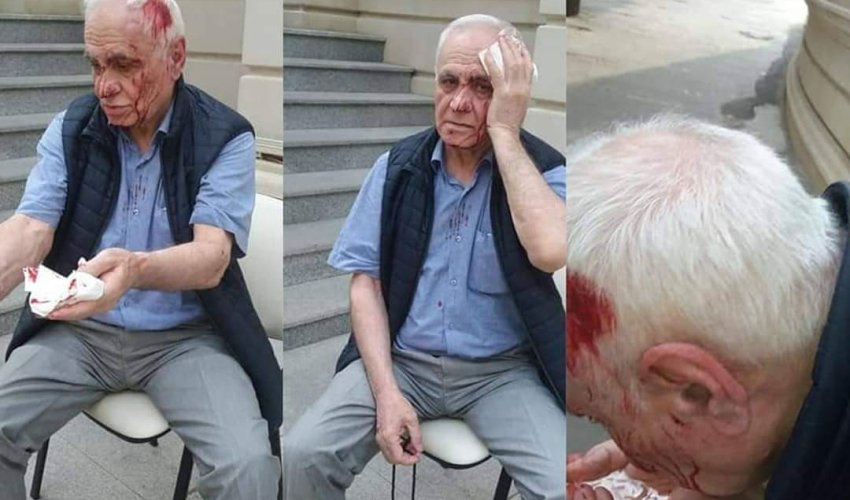 Bakıda keçmiş nazirə hücum: Başını yardılar - FOTO