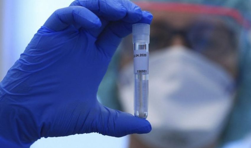 Son sutkada koronavirusdan 6 nəfər öldü Son sutkada koronavirusdan 6 nəfər öldü