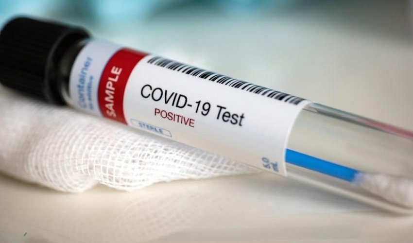 В Японии число заразившихся COVID-19 превысило 20 тысяч В Японии число заразившихся COVID-19 превысило 20 тысяч