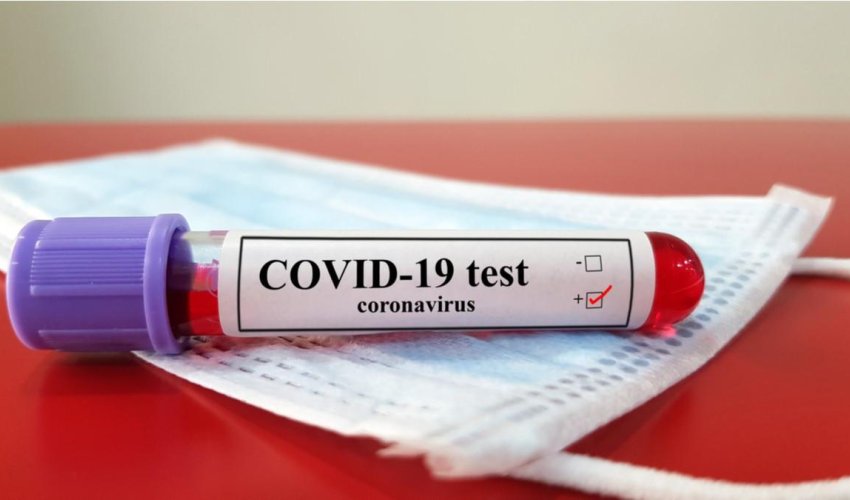 Число случаев COVID-19 в Армении превысило 39 тыс.