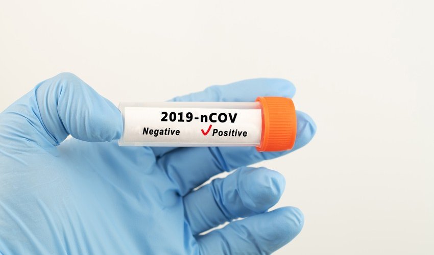 В Азербайджане выявлено 988 новых фактов заражения COVID-19 за сутки В Азербайджане выявлено 988 новых фактов заражения COVID-19 за сутки