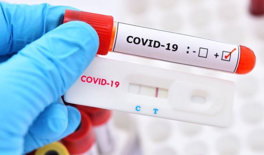 Gürcüstanda koronavirusa yoluxanların sayı 37 mini ötdü Gürcüstanda koronavirusa yoluxanların sayı 37 mini ötdü
