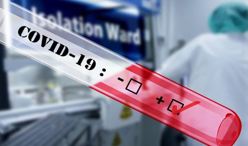 Bu şəxslərdən koronavirus testi götürülməyəcək Bu şəxslərdən koronavirus testi götürülməyəcək