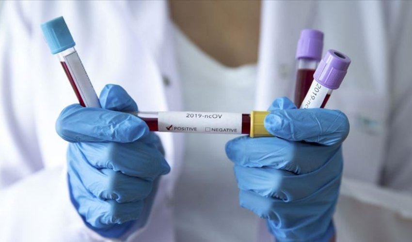 Koronavirus nə zaman bitəcək? - Alimdən AÇIQLAMA